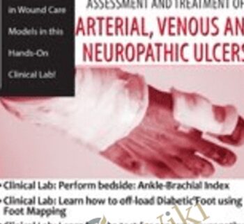 Hands-On Clinical Lab: Assessment and Treatment of Arterial, Venous and Neuropathic Ulcers - Kim Saunders