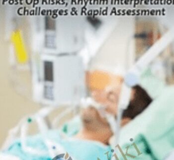 Life Threatening Complications: Post Op Risks, Rhythm Interpretation Challenges & Rapid Assessment Skills - Casseopia Fisher & Marcia Gamaly