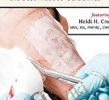 Palliative Wound Care: Realistic Wound Management Goals and Best-Practice Guidelines - Heidi Huddleston Cross