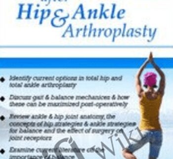 Restoring Balance & Function after Hip & Ankle Arthroplasty - Jason Handschumacher