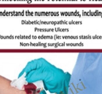 Wound Care: Unlocking the Potential to Heal - Joan Junkin