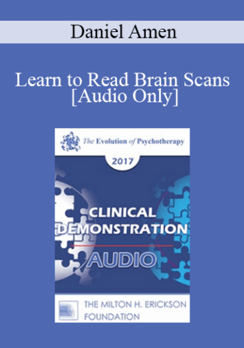 [Audio] EP17 Clinical Demonstration 10 - Learn to Read Brain Scans: 50 cases in 60 Minutes - Daniel Amen, MD