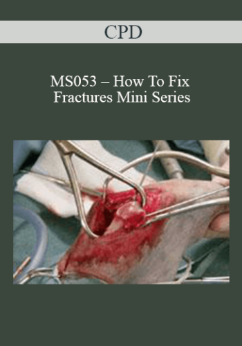CPD – MS053 – How To Fix Fractures Mini Series