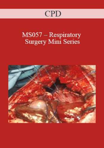 CPD – MS057 – Respiratory Surgery Mini Series