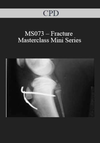 CPD - MS073 – Fracture Masterclass Mini Series