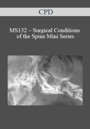 CPD – MS132 – Surgical Conditions Of The Spine Mini Series
