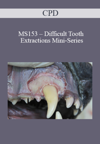 CPD - MS153 – Difficult Tooth Extractions Mini-Series