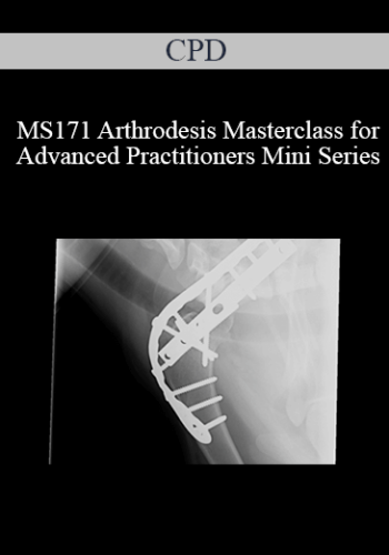 CPD – MS171 Arthrodesis Masterclass For Advanced Practitioners Mini Series