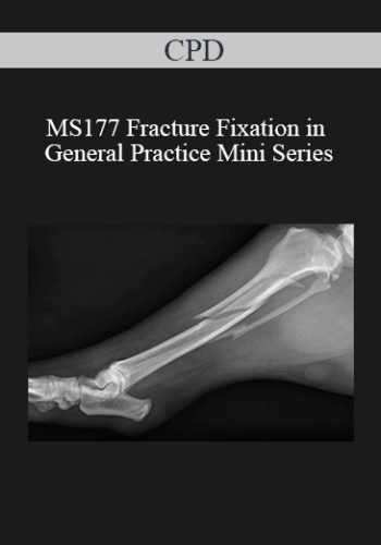 CPD – MS177 Fracture Fixation In General Practice Mini Series