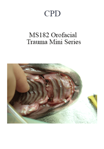 CPD – MS182 Orofacial Trauma Mini Series