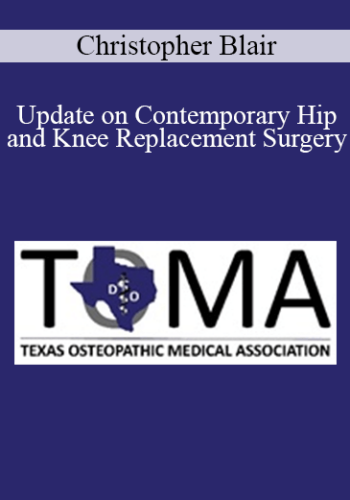 Christopher Blair – Update On Contemporary Hip And Knee Replacement Surgery