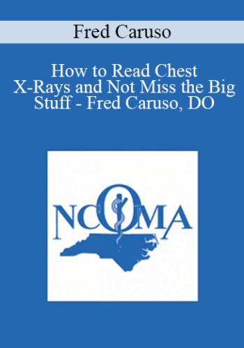 Fred Caruso - How to Read Chest X-Rays and Not Miss the Big Stuff - Fred Caruso, DO