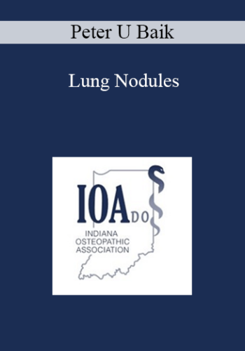 Peter U Baik - Lung Nodules