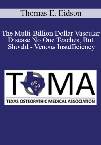 Thomas E. Eidson – The Multi-Billion Dollar Vascular Disease No One Teaches, But Should – Venous Insufficiency