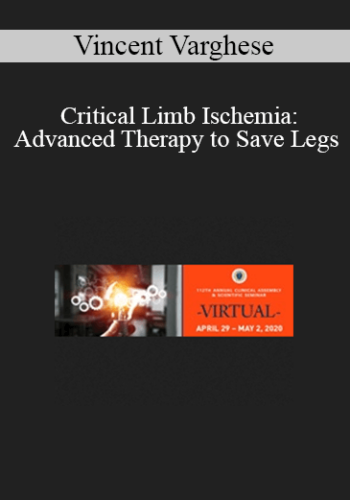 Vincent Varghese - Critical Limb Ischemia: Advanced Therapy to Save Legs